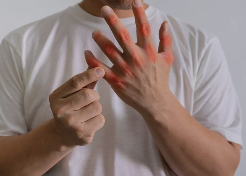 kako ukloniti mokraćnu kiselinu